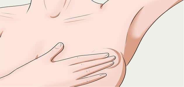 ما هي أعراض مرض سرطان الثدي بالتفصيل