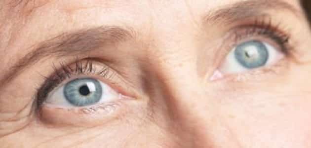 مرض المياه الزرقاء والبيضاء في العين