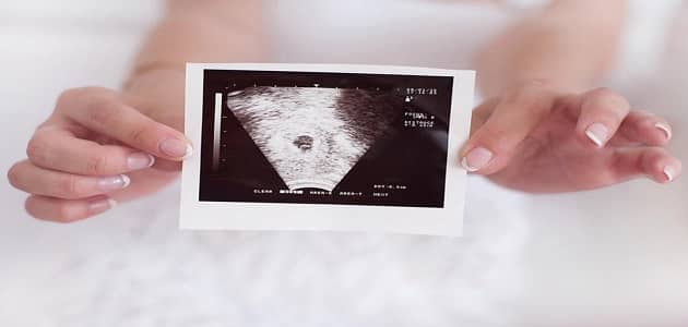 الحمل العنقودي وارتفاع هرمون الحمل
