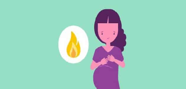 حرقان المعدة للحامل وجنس الجنين مقال