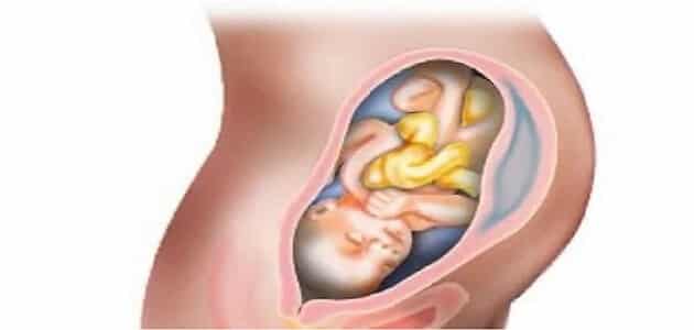 وضعية الجنين في الشهر الثالث من الحمل