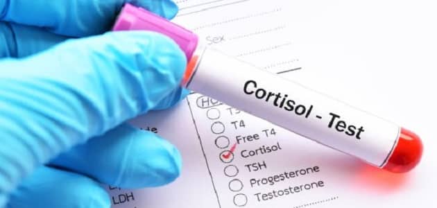 علاج ارتفاع هرمون الكورتيزول