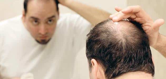 علاج تساقط الشعر للرجال وتكثيفه - مقال