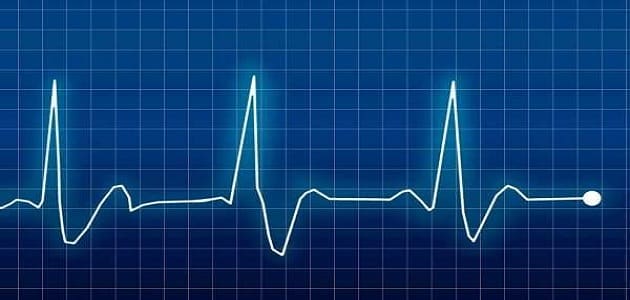 معلومات عن جهاز قياس نبضات القلب