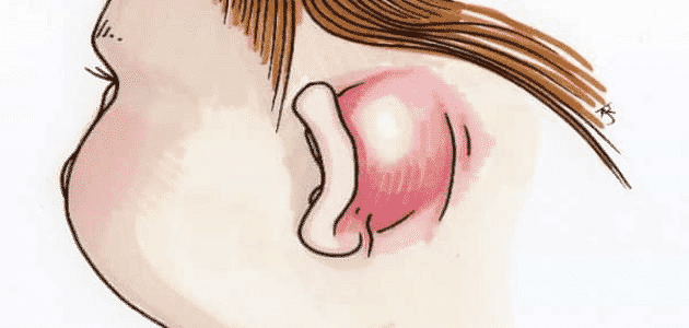 أسباب التهاب الأذن