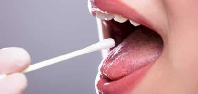 علاج كثرة اللعاب في الفم بالأعشاب