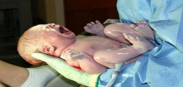 علاج الخياطة بعد الولادة الطبيعية بالاعشاب - مقال