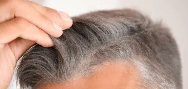 علاج ظهور الشعر الأبيض في سن الثلاثين
