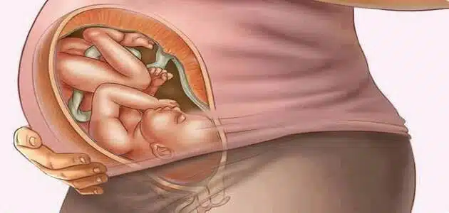 اذا فتح الرحم 5 سم متى تكون الولادة